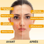 Anti-blemish mask with turmeric